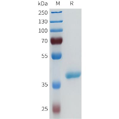 Human ENPP3(94-159) Protein, hFc Tag