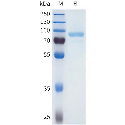 Human SEMA4A Protein, His Tag