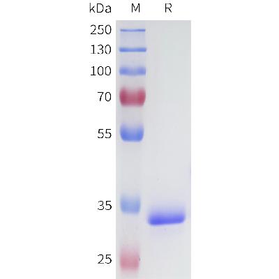 Human CA9(138-414) Protein, His Tag