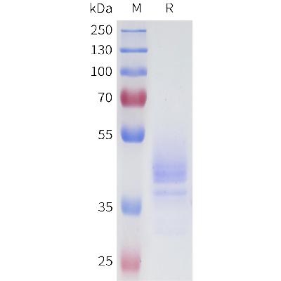 Human 5T4(256-355) Protein, hFc Tag