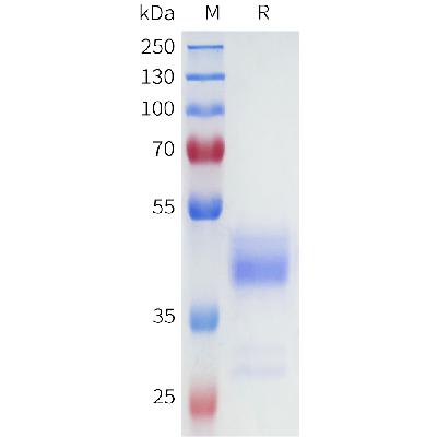 Human NK1R Protein, hFc Tag