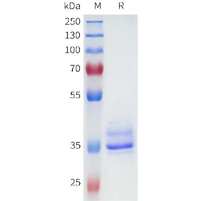 Human QRFPR Protein, hFc Tag