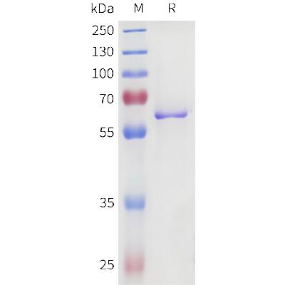 Human PRAME Protein, Flag Tag