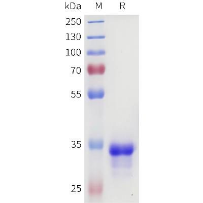 Human 4-1BB(87-118) Protein, hFc Tag