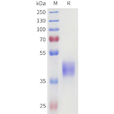 Human 4-1BB(119-160) Protein, hFc Tag