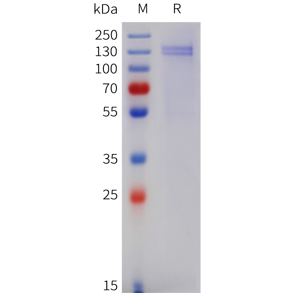 Recombinant human COMP Protein with C-terminal 6?His tag