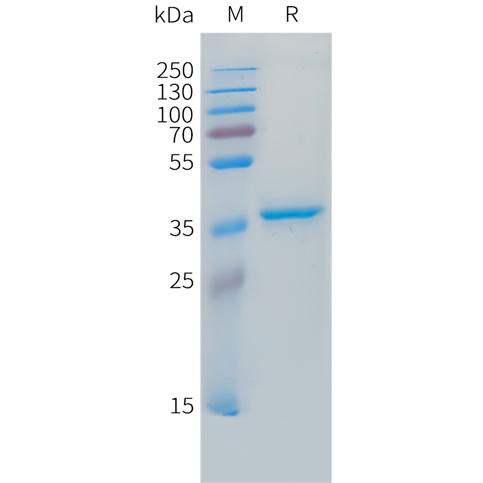 Recombinant human IGF2 Protein with N-terminal human Fc tag