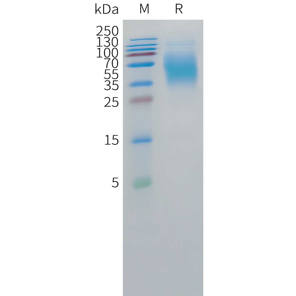Recombinant human CEACAM5(496-685) Protein with C-terminal 10?His tag