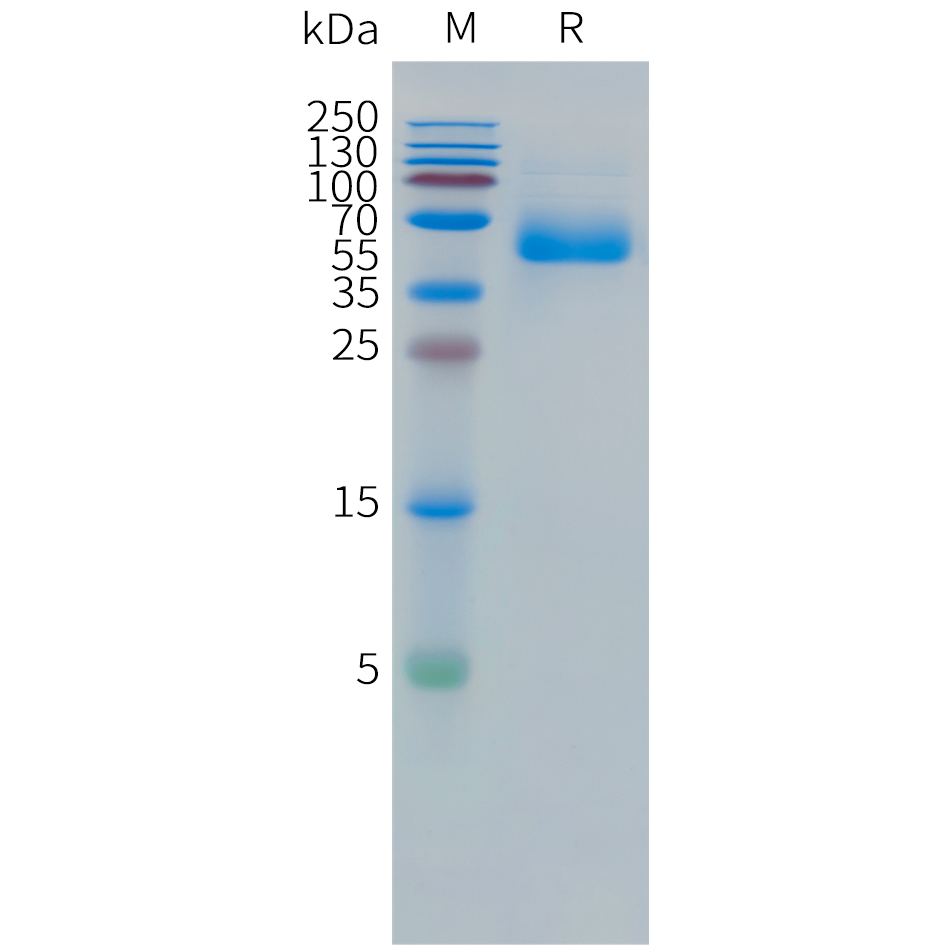 Recombinant human CEACAM5(589-685) Protein with C-terminal human Fc tag