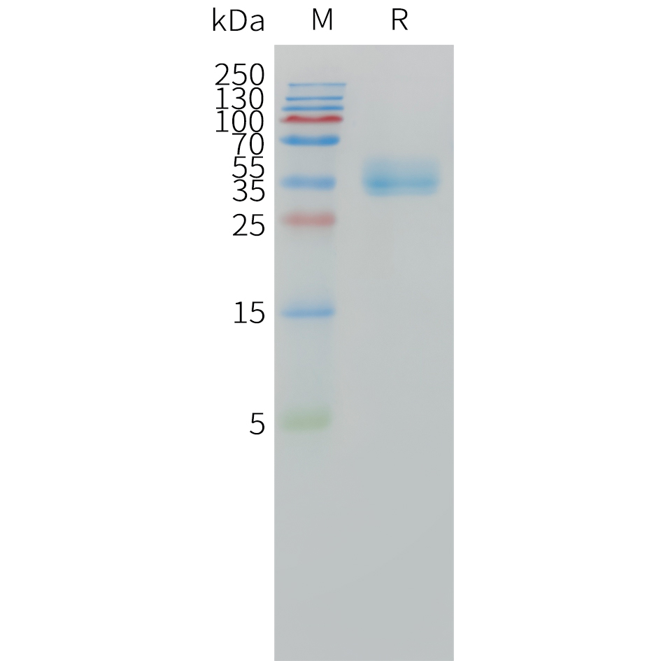 Recombinant human CA12 Protein with C-terminal 10?His tag