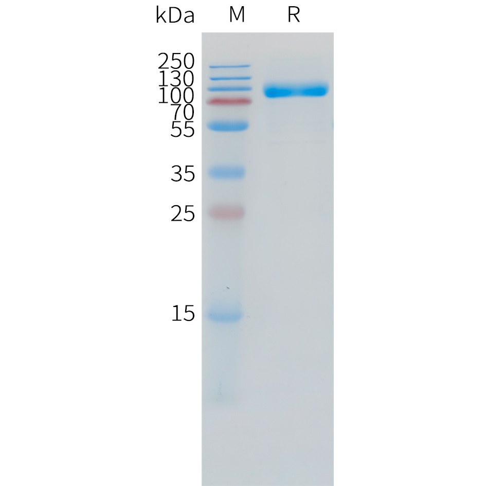 Recombinant human IL1R2 Protein with C-terminal human Fc tag