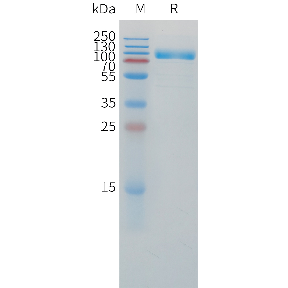 Recombinant human IL1R2 Protein with C-terminal mouse Fc tag