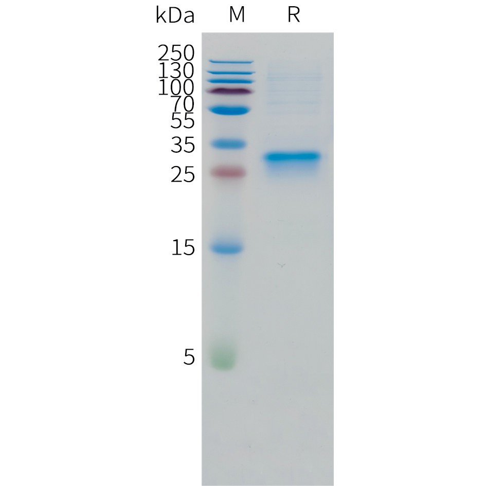 Recombinant human OSM Protein with C-terminal 10?His tag