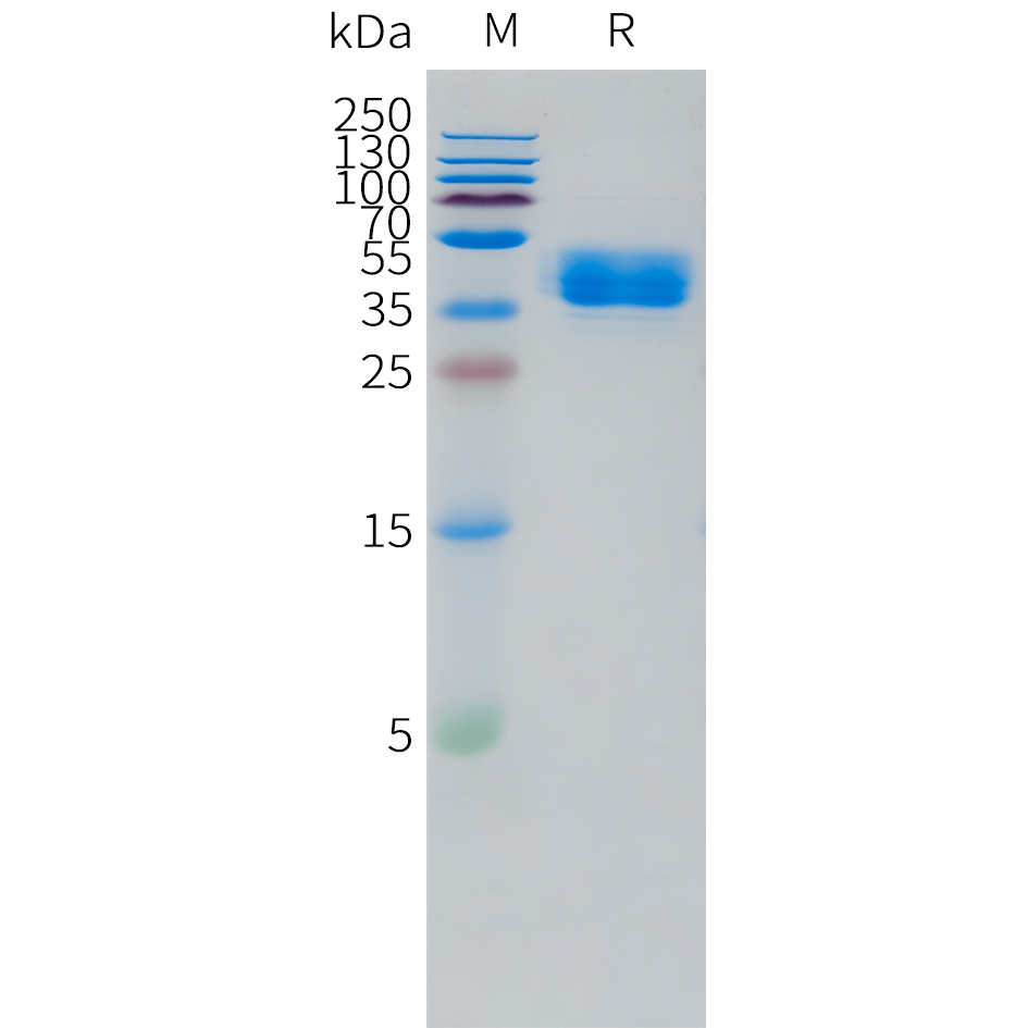 Recombinant human TRHR Protein with C-terminal human Fc tag