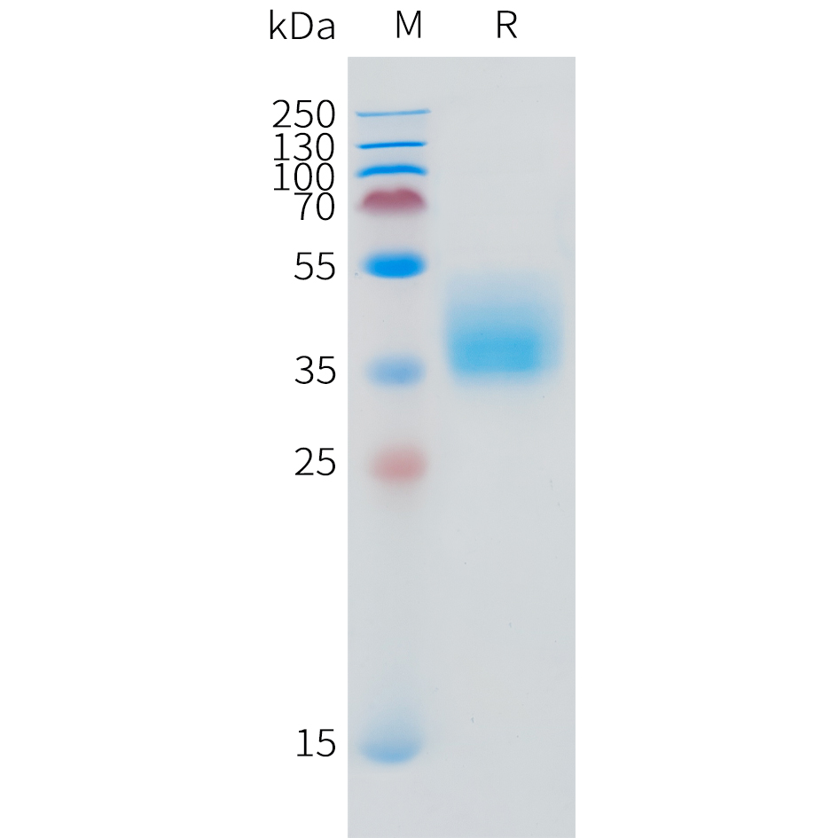 Recombinant human IFNGR1 Protein with C-terminal 10?His tag