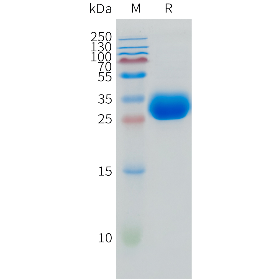 Recombinant human LAMP5 Protein with C-terminal 10?His tag