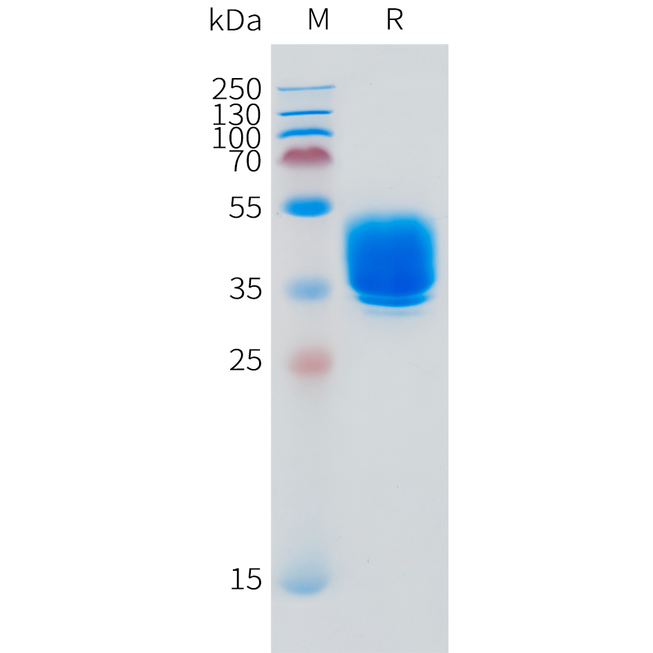 Recombinant human GPBAR1 Protein with C-terminal human Fc tag