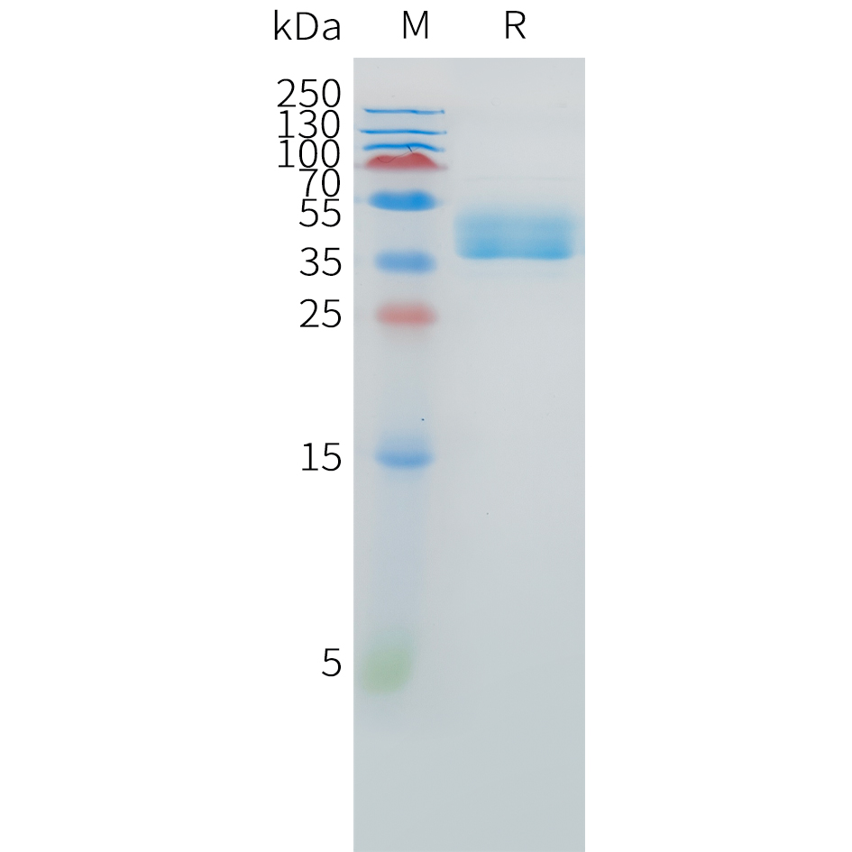 Recombinant human EDNRB Protein with C-terminal human Fc tag