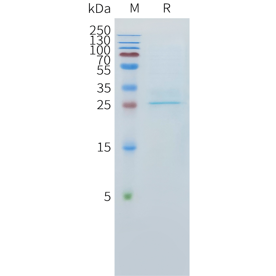Recombinant human CLEC1A Protein with C-terminal 10?His tag