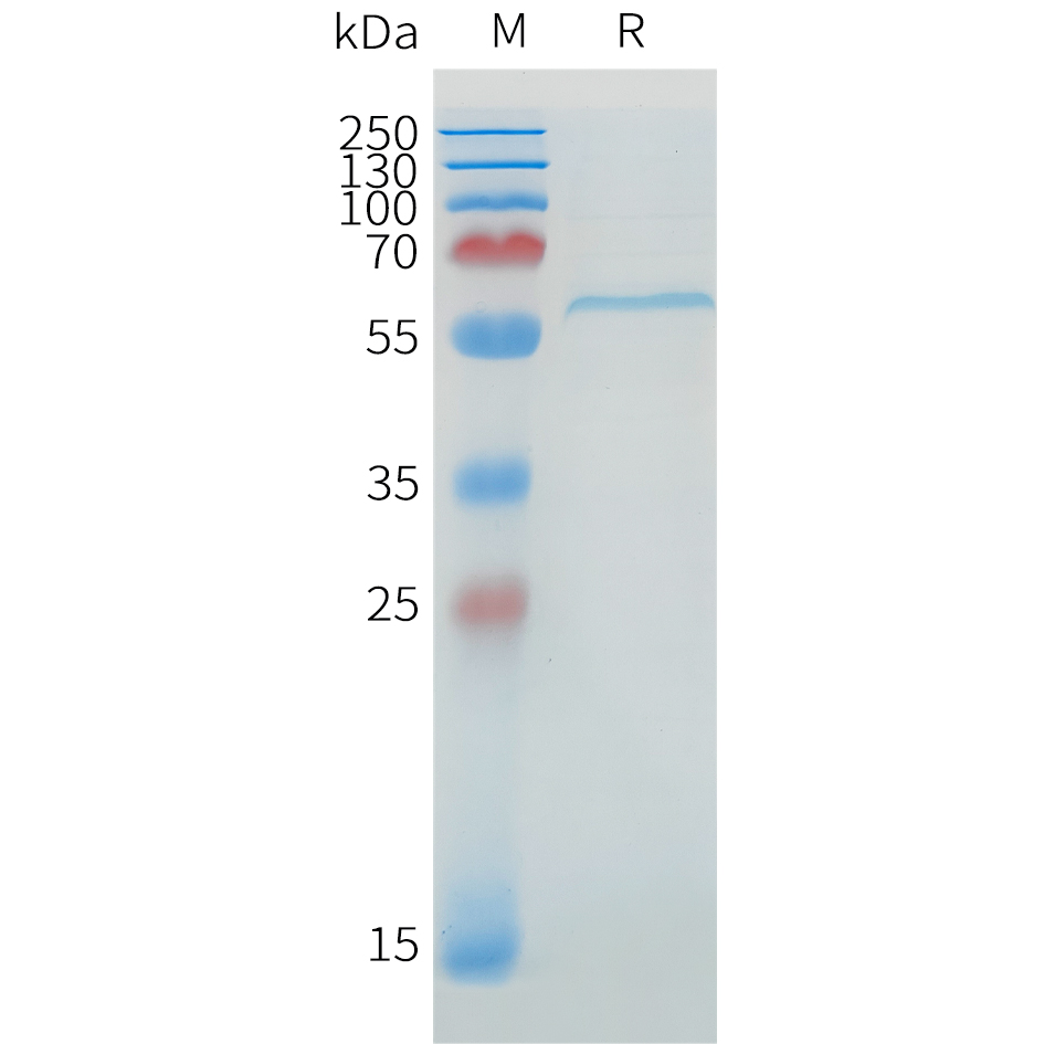 Recombinant human DLL1 Protein with C-terminal 6?His tag