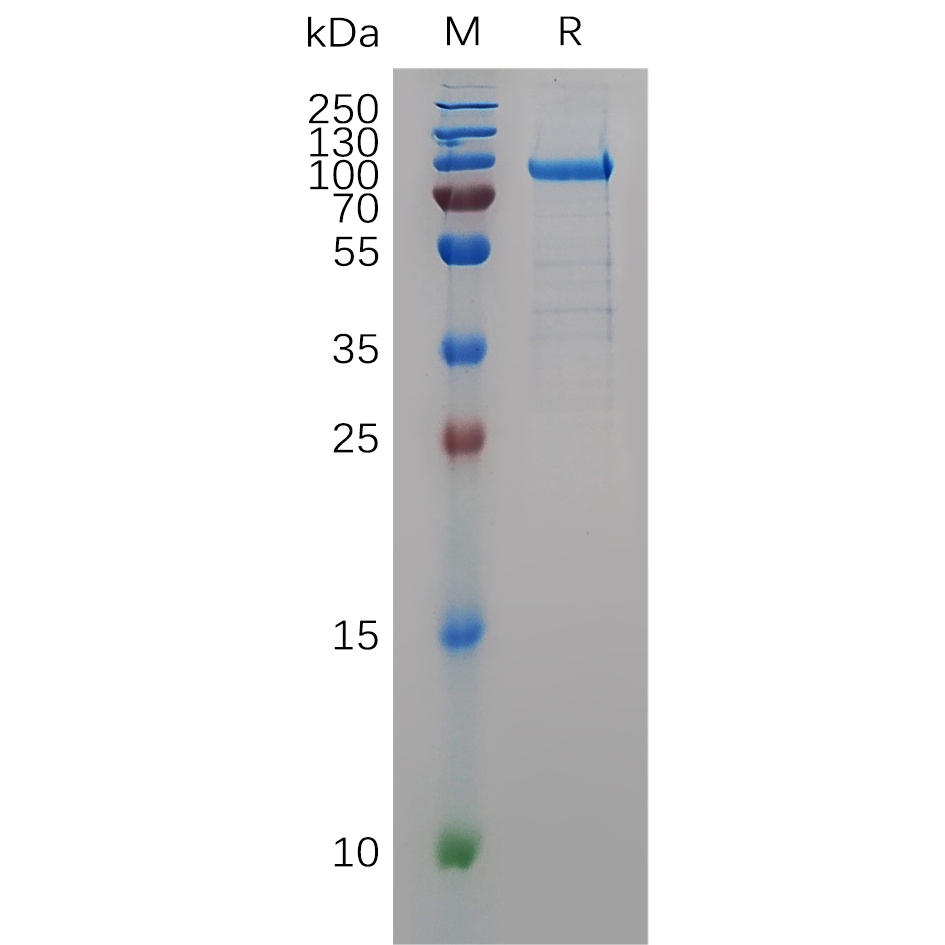 Recombinant human MMP9(32-488) Protein with C-terminal human Fc tag