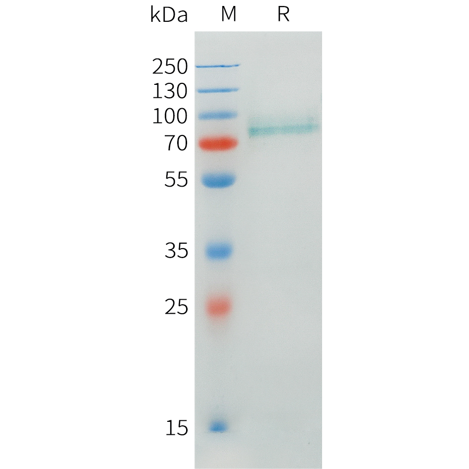 Recombinant human CRTAM Protein with C-terminal human Fc tag