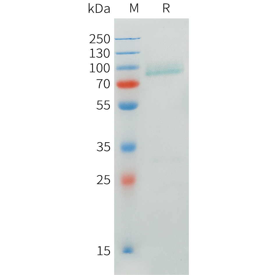 Recombinant human CRTAM Protein with C-terminal mouse Fc tag