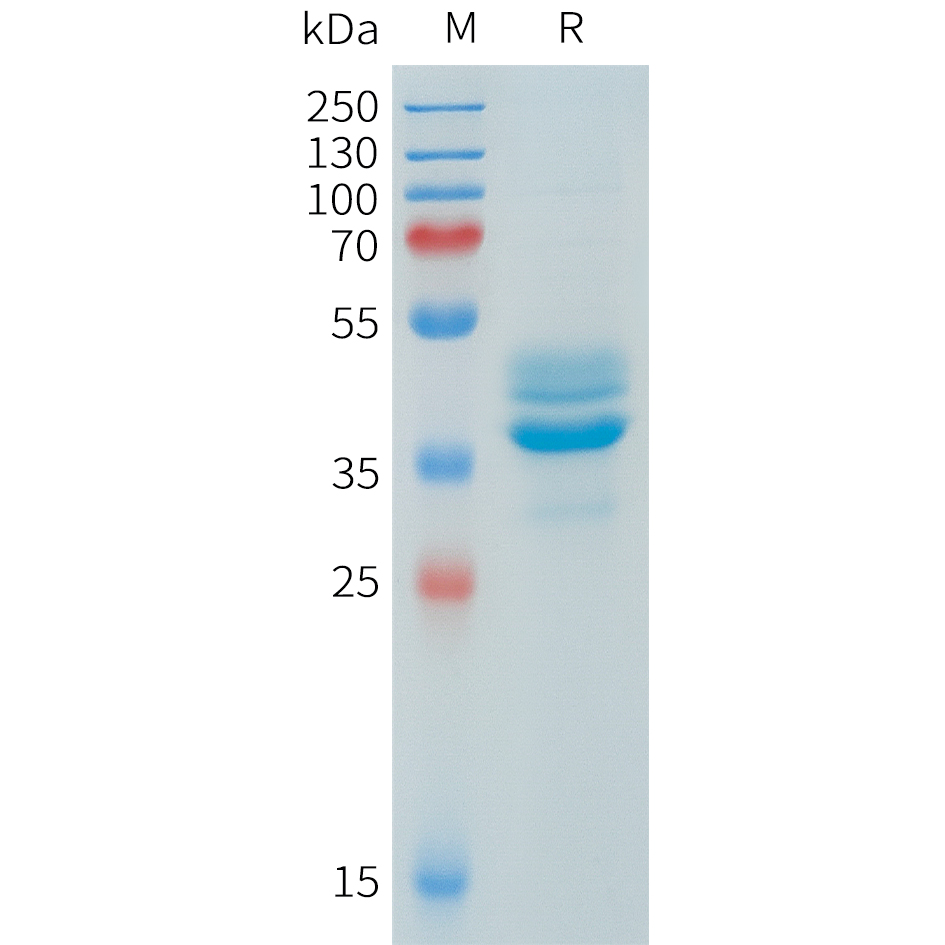 Recombinant human AKT1(409-480) Protein with N-terminal human Fc tag