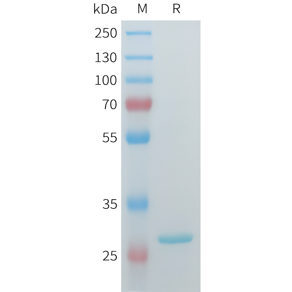 Recombinant human HSD17B10 Protein with C-terminal 3?Flag tag
