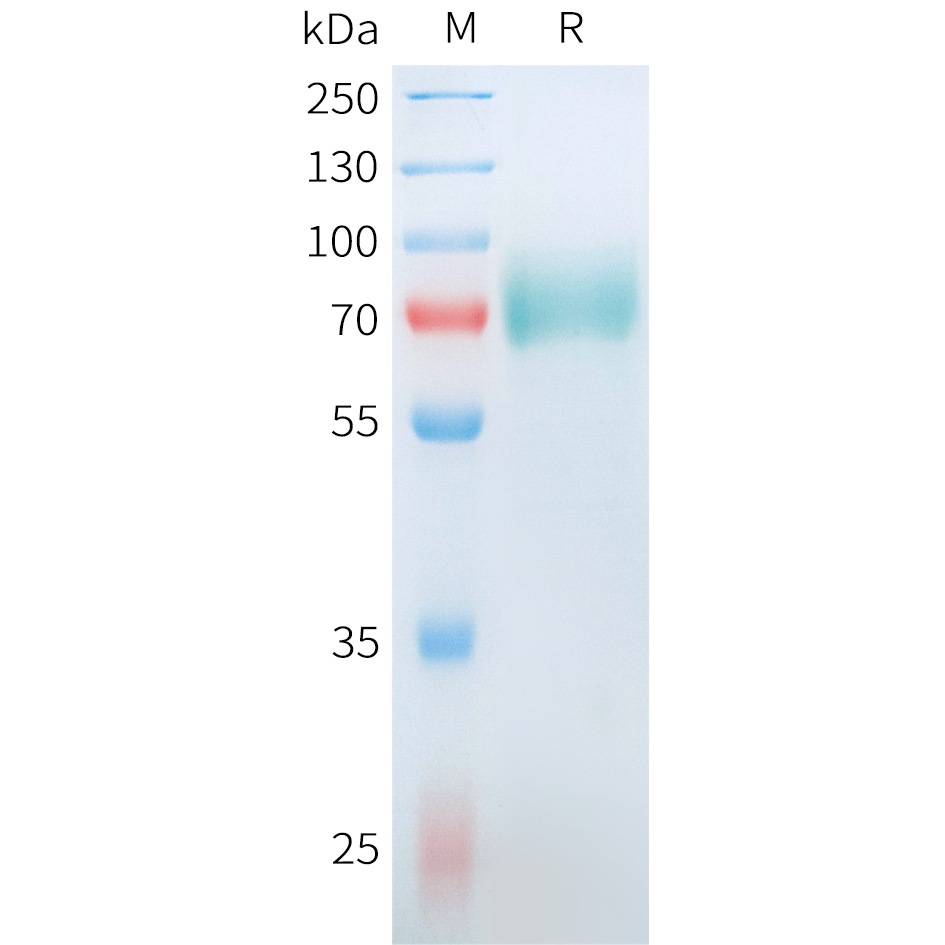 Recombinant human CD19(M75I,L82V,F83L) Protein with C-terminal human Fc tag