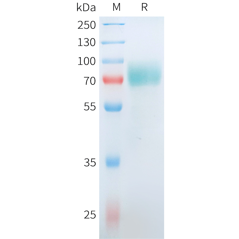 Recombinant human CD19(M75V,R76S,F85S) Protein with C-terminal human Fc tag
