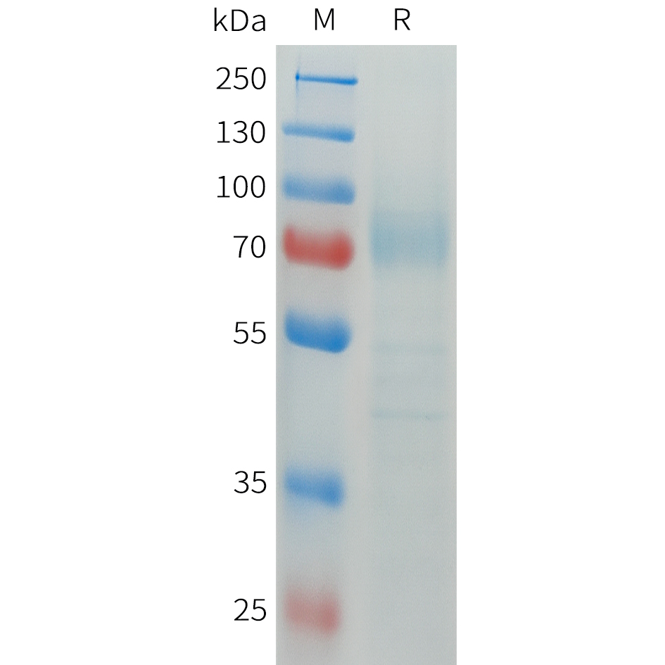 Recombinant human FCGR1A Protein with C-terminal human Fc tag