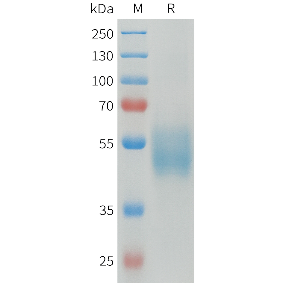 Recombinant human FCGR1A Protein with C-terminal 6?His tag