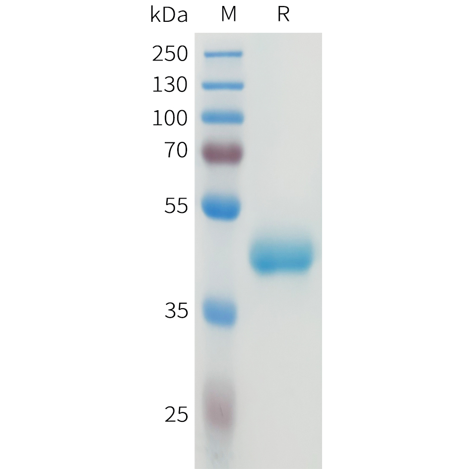 Recombinant human CEACAM5(35-144) Protein with C-terminal human Fc tag