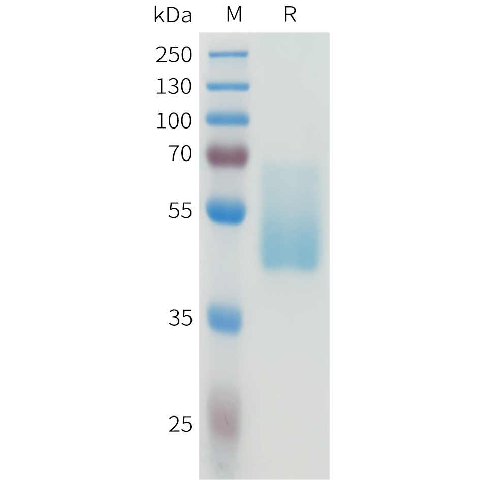 Recombinant human CEACAM5(411-500) Protein with C-terminal human Fc tag