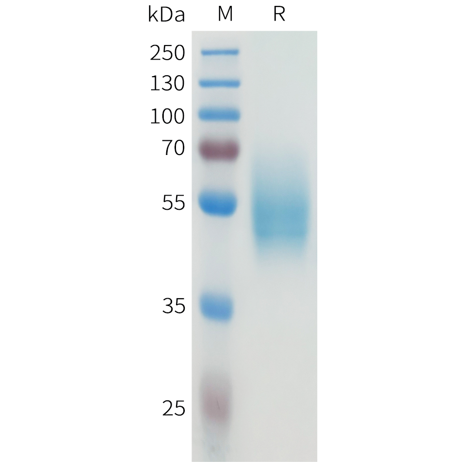 Recombinant human CEACAM5(496-592) Protein with C-terminal human Fc tag
