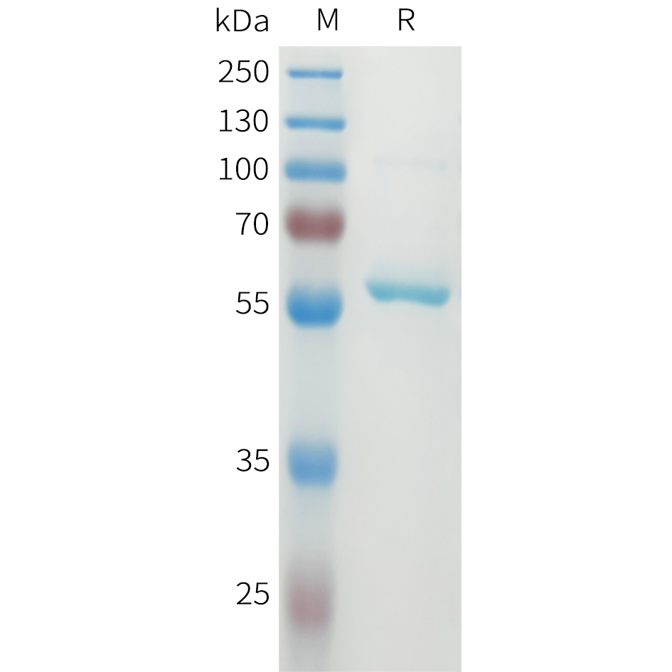 Recombinant human DLL3(27-175) Protein with N-terminal MBP tag and C-terminal 10?His tag