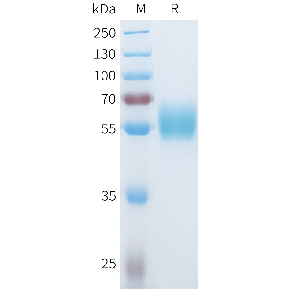 Recombinant human ROR1(30-164) Protein with C-terminal human Fc tag