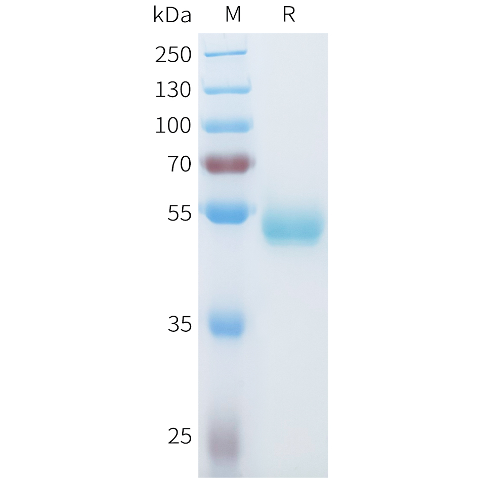 Recombinant human ROR1(148-311) Protein with C-terminal human Fc tag