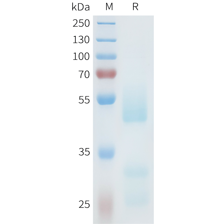 Recombinant human AXL(332-451) Protein with C-terminal human Fc tag