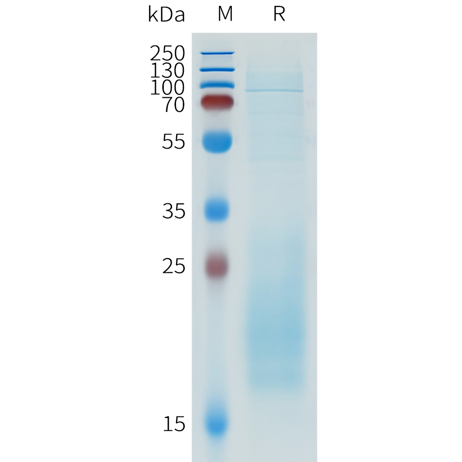 Recombinant human IL31 Protein with C-terminal 10?His tag