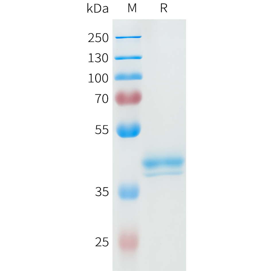 Recombinant human ROR2(304-403) Protein with C-terminal human Fc tag