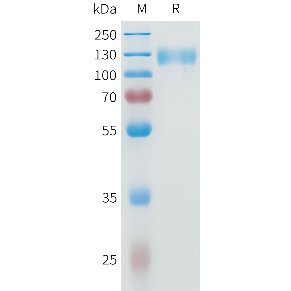 Recombinant human IL31RA Protein with C-terminal human Fc tag