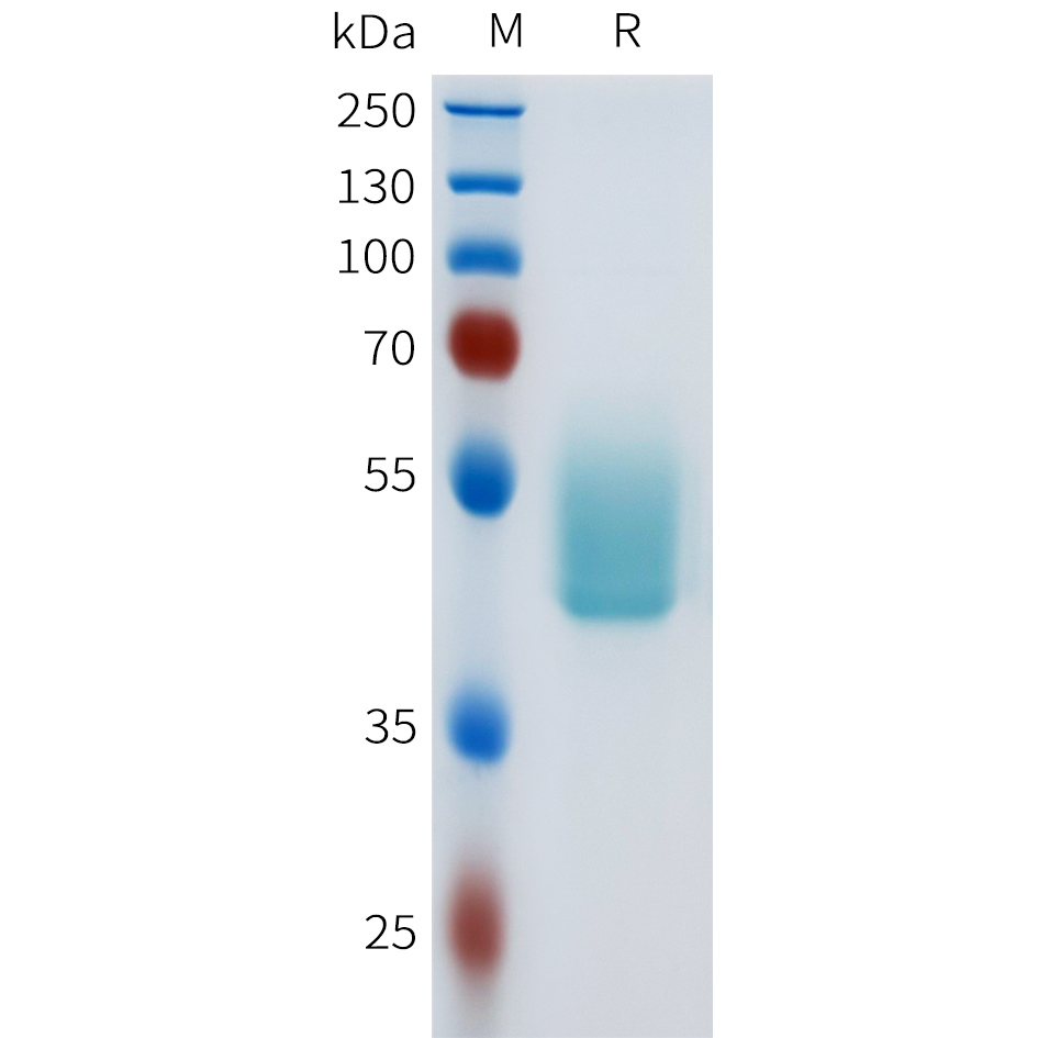 Recombinant human CD117(411-524) Protein with C-terminal human Fc tag
