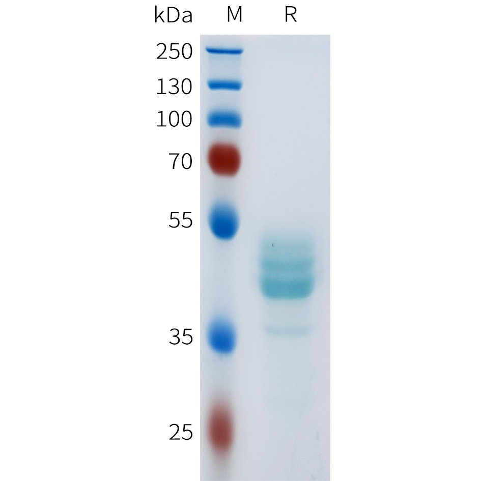 Recombinant human CDH17(668-787) Protein with C-terminal human Fc tag