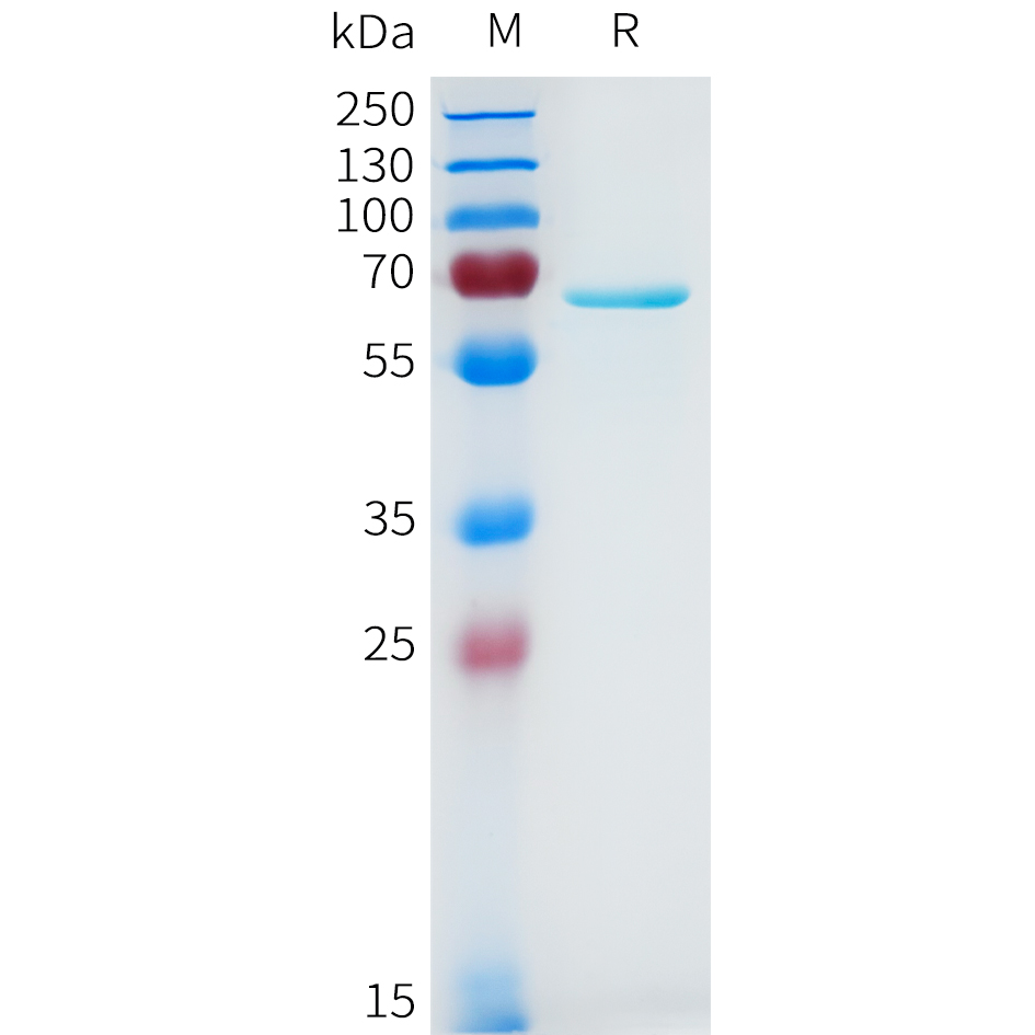 Recombinant human AKT1 Protein with C-terminal 3?Flag tag