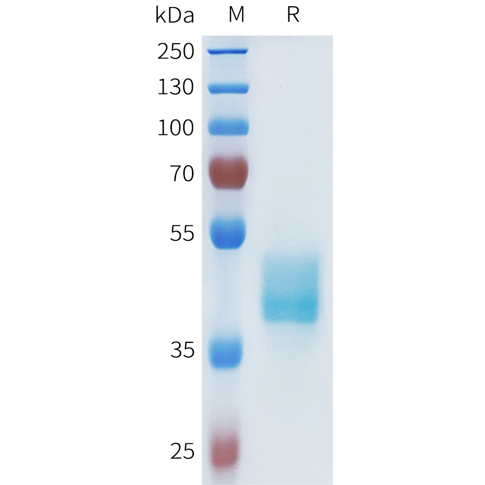 Recombinant human ASGR1(61-160) Protein with N-terminal human Fc tag