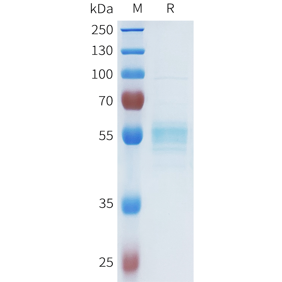 Recombinant human ASGR1(124-291) Protein with N-terminal human Fc tag