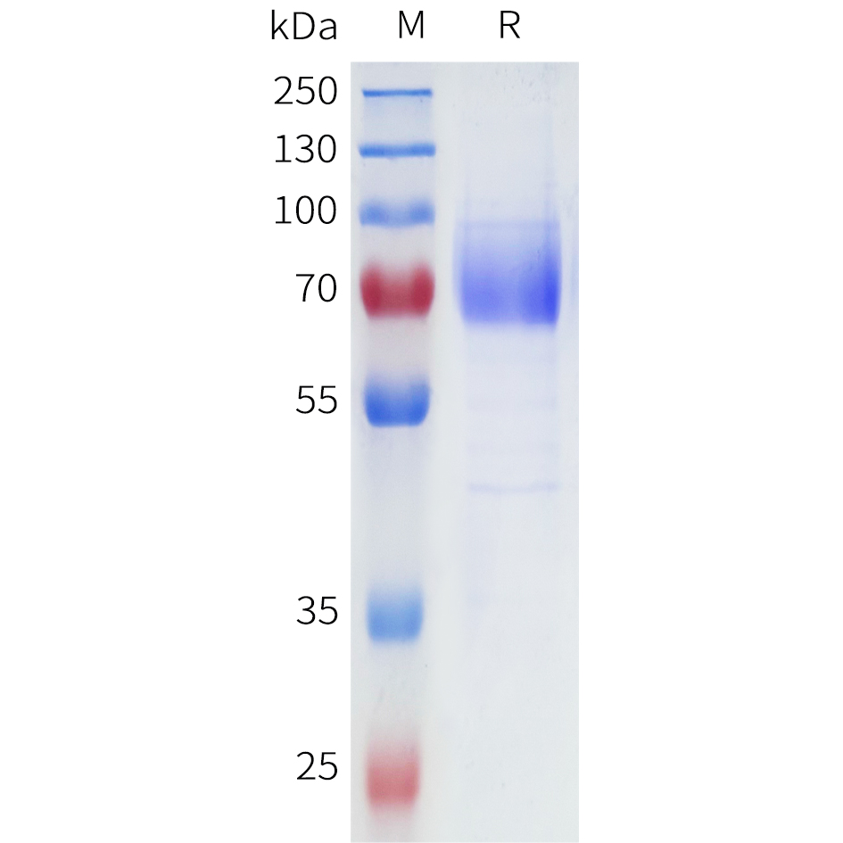 Recombinant human IL31RA(20-225) Protein with C-terminal human Fc tag