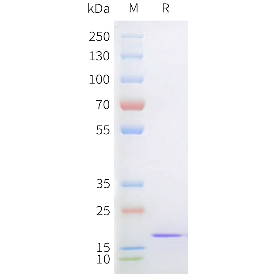 Recombinant Staphylococcus aureus sortase A 5M Protein with C-terminal 6?His tag